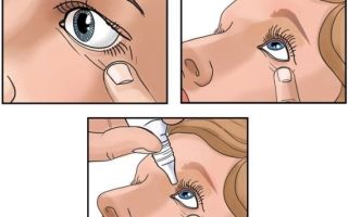 Chinese eye drops with vitamins