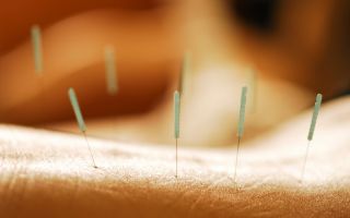 Why acupuncture is useful and what is it treated