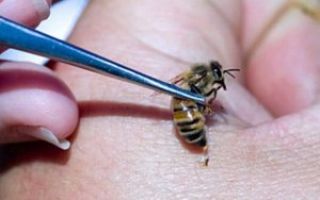 Bee venom: benefits and harms, what to do with a bee sting at home