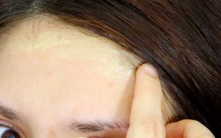 How to scrub hair dye from skin