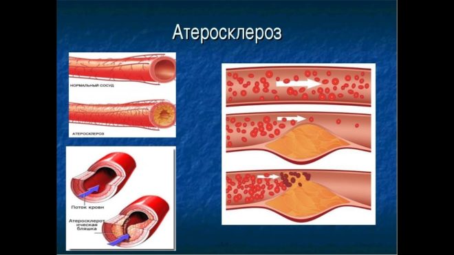 recomandări pentru utilizarea cardiomagnilului