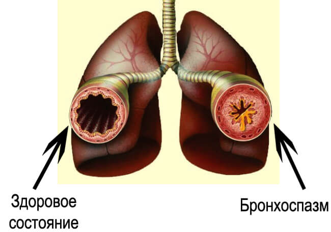 cardiomagnet - efecte secundare și contraindicații